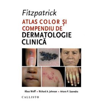 Fitzpatrick. Atlas color si compendiu de dermatologie clinica - Klaus Wolff
