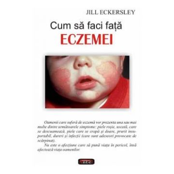 Cum sa faci fata eczemei - Jill Eckersley
