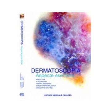Dermatoscopia. Aspecte esentiale - Robert Johr, H. Peter Soyer