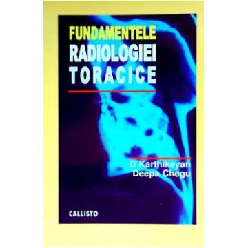 Fundamentele radiologiei toracice - D. Karthikeyan, Deepa Chegu