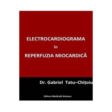 Electrocardiograma in reperfuzia miocardica