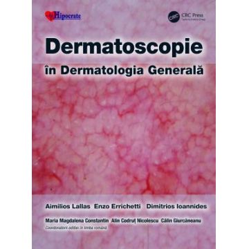 Dermatoscopie in Dermatologia Generala