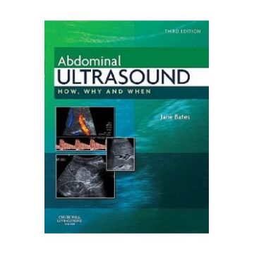 Abdominal Ultrasound: How, Why and When - Jane Bates